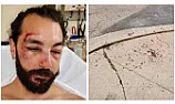 A hit-and-run scooter crash nearly killed him. Now he's fighting for the data that could reveal the rider's identity. [telecom]  | &laquo; previous thread